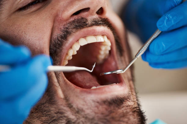 Best Emergency Gum Treatment in Gleed, WA
