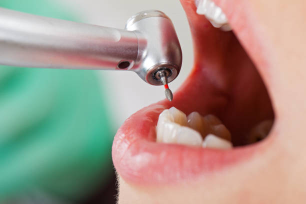Best Urgent Care for Lost Fillings or Crowns in Gleed, WA